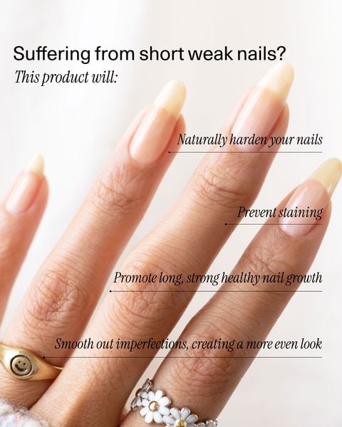 【Έκπτωση περιορισμένης διάρκειας: Αγοράστε 1, πάρτε 2 δωρεάν】KeraStrong - Το ελιξίριο αναδόμησης νυχιών - 50% έκπτωση