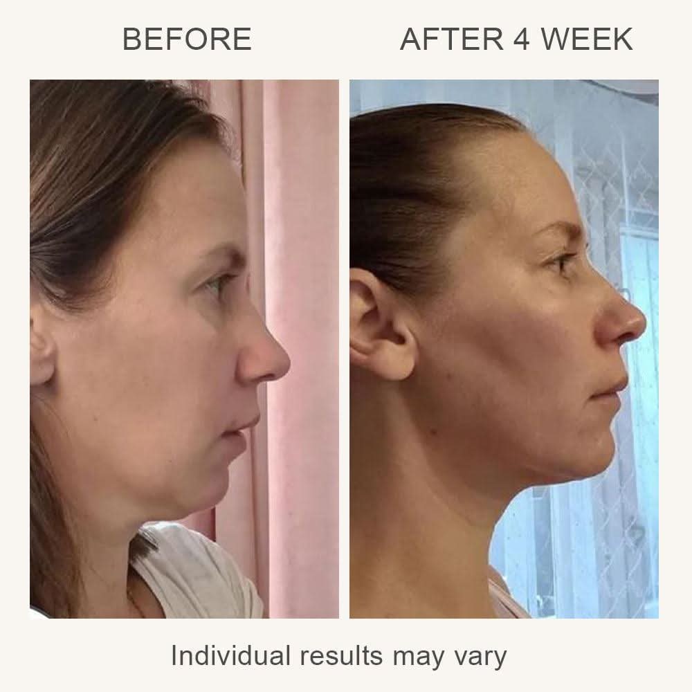 EELHOE Ζεστή & Κρύα Συσκευή Ομορφιάς