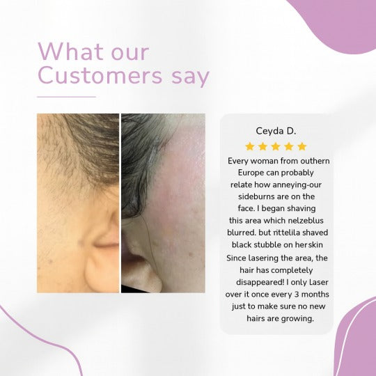 Αποτριχωτική συσκευή Ylvis IPL – Λείο, χωρίς τρίχες δέρμα από το σπίτι