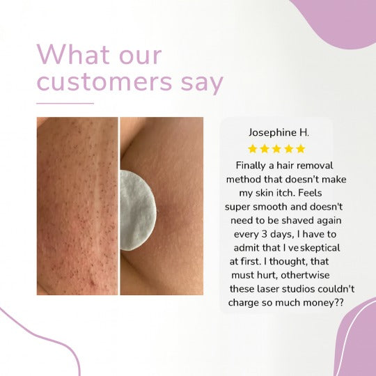 Αποτριχωτική συσκευή Ylvis IPL – Λείο, χωρίς τρίχες δέρμα από το σπίτι